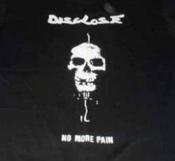 Disclose : No More Pain